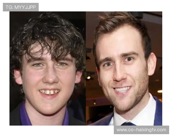 足球球星换牙事件揭秘 从牙齿到笑容的背后故事